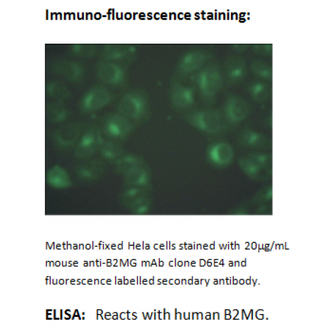 mAb anti-Human B2MG, D6E4